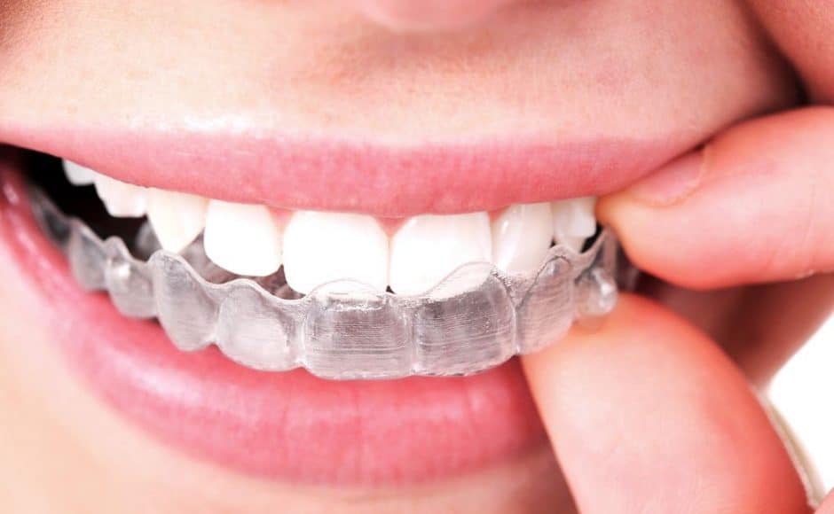 Comment combler un espace entre deux dents naturellement ?